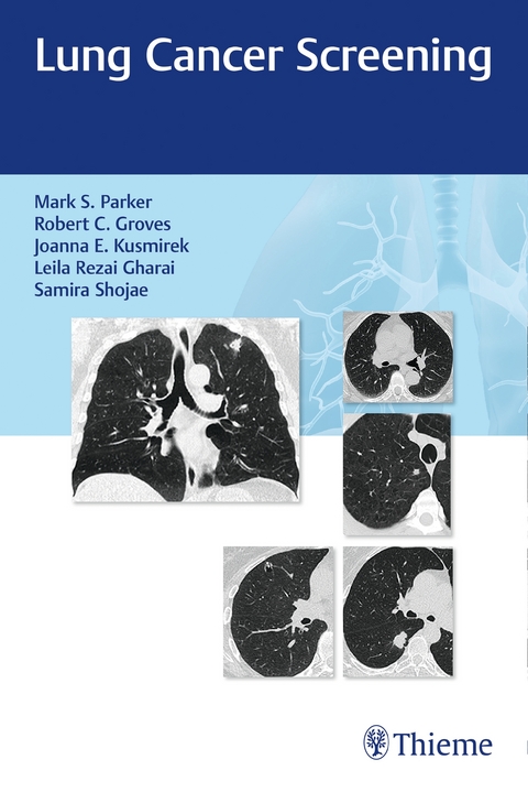 Lung Cancer Screening - 