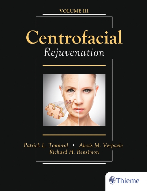 Centrofacial Rejuvenation - Patrick Tonnard, Alexis Verpaele, Richard Bensimon