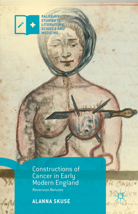Constructions of Cancer in Early Modern England - Alanna Skuse