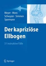 Der kapriziöse Ellbogen - 