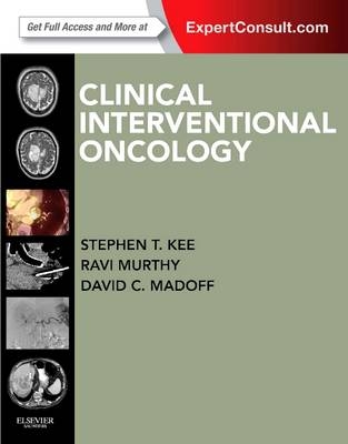 Clinical Interventional Oncology E-Book - Stephen T Kee, David C Madoff, Ravi Murthy