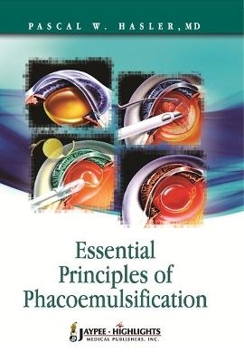 Essential Principles of Phacoemulsification - Pascal W Hasler