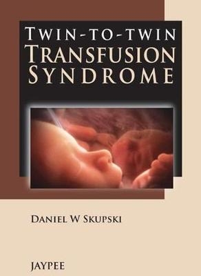 Twin-to-Twin Transfusion Syndrome - Daniel W Skupski