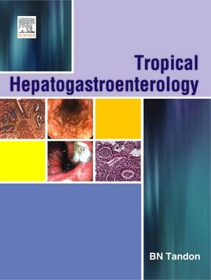 Tropical Hepato-Gastroenterology - B. N. Tandon