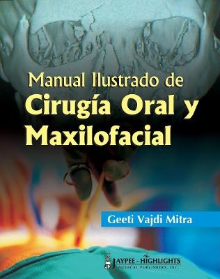 Manual Ilustrado de Cirugía Oral y Maxilofacial - Geeti Vajdi Mitra