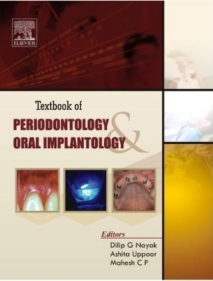 Textbook of Periodontology and Oral Implantology - 