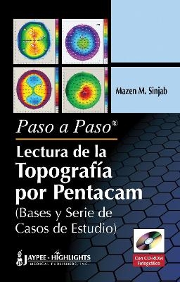 Paso a Paso - Lectura de la Topografía por Pentacam - Mazen M Sinjab