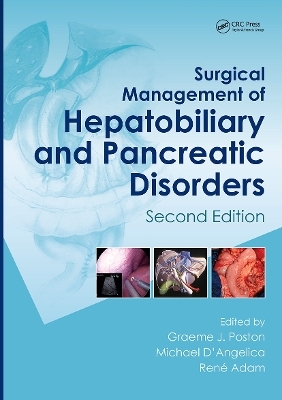 Surgical Management of Hepatobiliary and Pancreatic Disorders - 