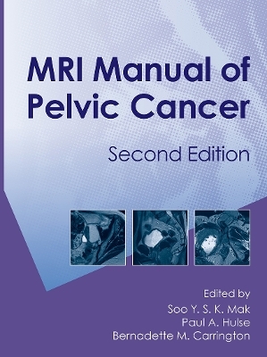 MRI Manual of Pelvic Cancer,Second Edition - 