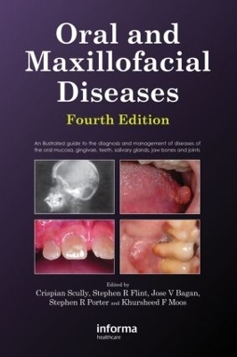 Oral and Maxillofacial Diseases, Fourth Edition - Crispian Scully, Stephen Flint
