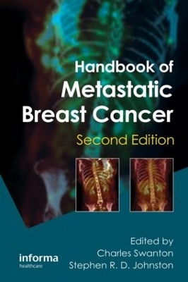 Handbook of Metastatic Breast Cancer - 