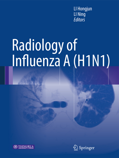 Radiology of Influenza A (H1N1) - 