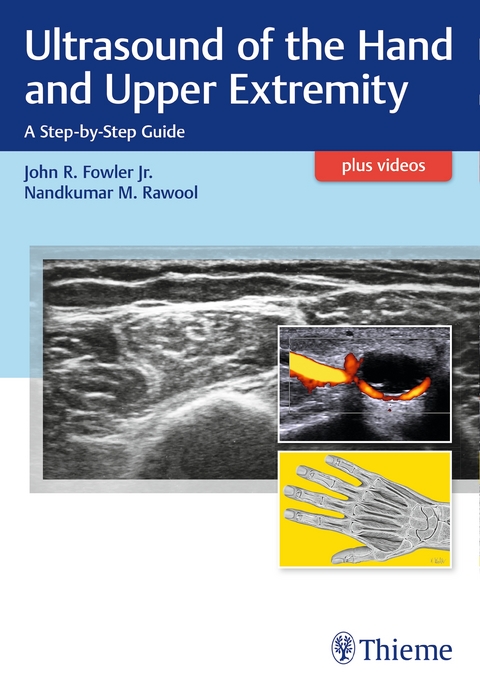 Ultrasound of the Hand and Upper Extremity - 