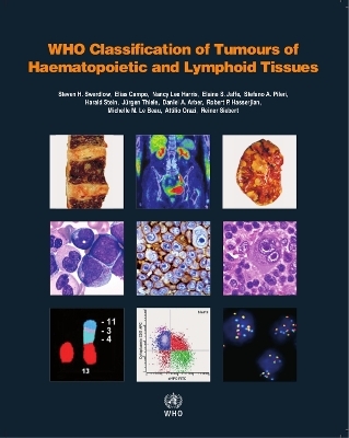 WHO classification of tumours of haematopoietic and lymphoid tissues -  International Agency for Research on Cancer