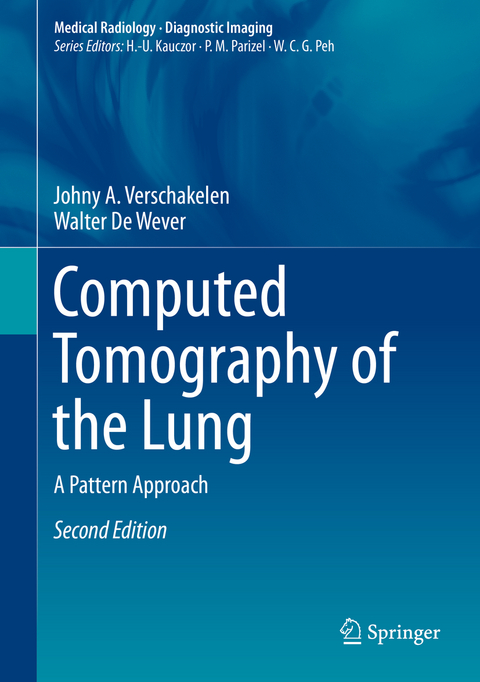 Computed Tomography of the Lung - Johny A. Verschakelen, Walter de Wever