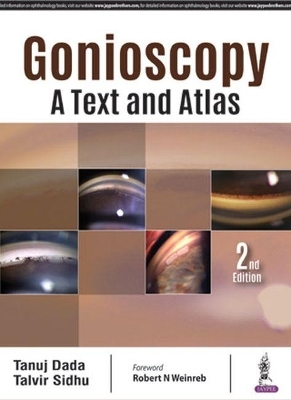 Gonioscopy: A Text and Atlas - Tanuj Dada, Talvir Sidhu