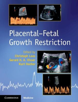 Placental-Fetal Growth Restriction - Christoph Lees, Gerard H. A. Visser, Kurt Hecher