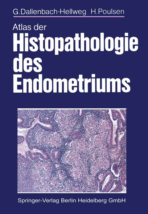 Atlas der Histopathologie des Endometriums - G. Dallenbach-Hellweg, H. Poulsen