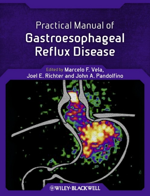 Practical Manual of Gastroesophageal Reflux Disease - 