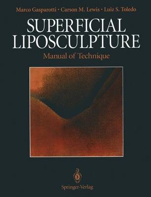 Superficial Liposculpture - Marco Gasparotti, Carson M Lewis, Luiz Toledo