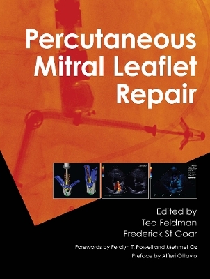 Percutaneous Mitral Leaflet Repair - 