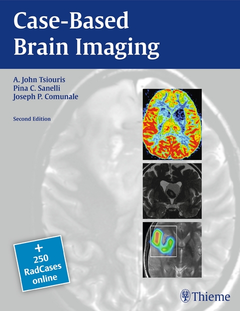 Case-Based Brain Imaging - A. John Tsiouris, Joseph Communale, Pina Sanelli