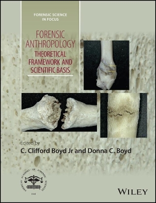 Forensic Anthropology - 