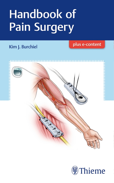 Handbook of Pain Surgery - Kim J. Burchiel