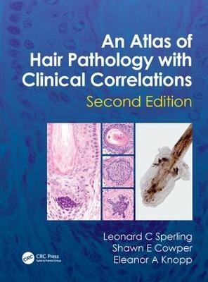 An Atlas of Hair Pathology with Clinical Correlations - Leonard C Sperling, Shawn E. Cowper, Eleanor A. Knopp
