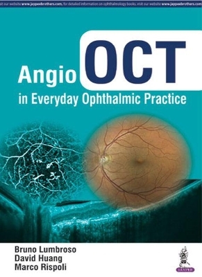 Angio OCT in Everyday Ophthalmic Practice - Bruno Lumbroso, David Huang, Marco Rispoli