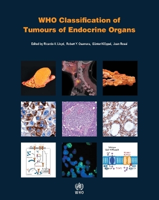 Who Classification of Tumours of Endocrine Organs -  International Agency for Research on Cancer