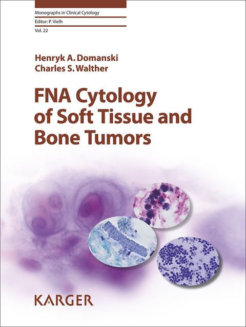 FNA Cytology of Soft Tissue and Bone Tumors - H.A. Domanski, C.S. Walther
