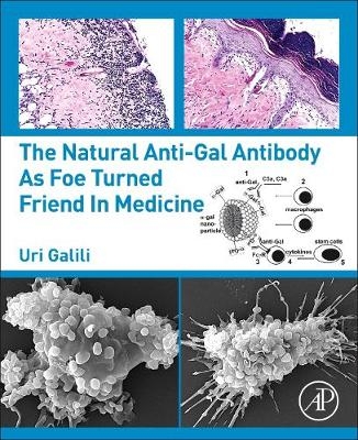 The Natural Anti-Gal Antibody as Foe Turned Friend in Medicine - Uri Galili