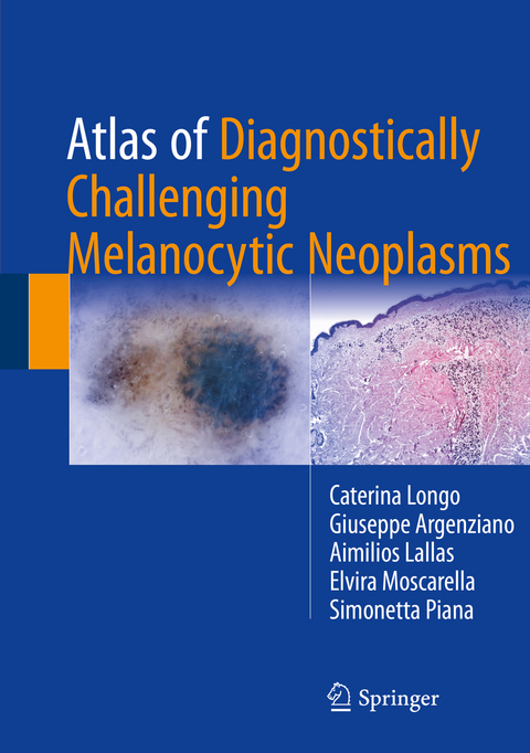Atlas of Diagnostically Challenging Melanocytic Neoplasms - Caterina Longo, Giuseppe Argenziano, Aimilios Lallas, Elvira Moscarella, Simonetta Piana