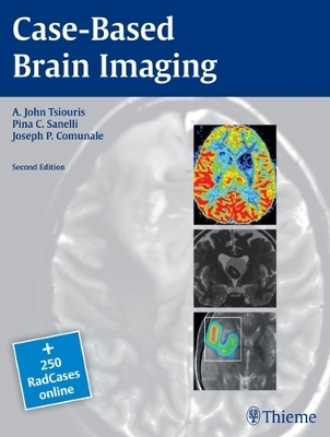 Case-Based Brain Imaging - Apostolos John Tsiouris, Pina C. Sanelli, Joseph Comunale