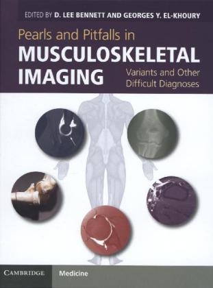 Pearls and Pitfalls in Musculoskeletal Imaging - 