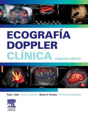 Ecograf�a Doppler Cl�nica + CD-ROM - Paul L Allan, W Norman McDicken, Myron A Pozniak, Paul A Dubbins