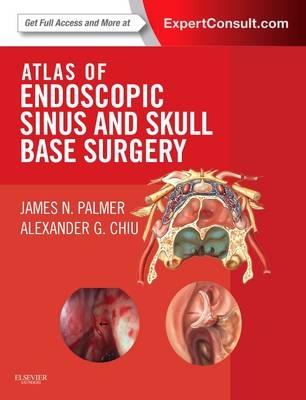 Atlas of Endoscopic Sinus and Skull Base Surgery - James N. Palmer, Alexander G. Chiu