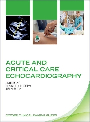 Acute and Critical Care Echocardiography - 