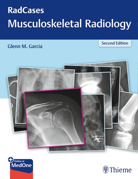 Radcases Musculoskeletal Radiology - 