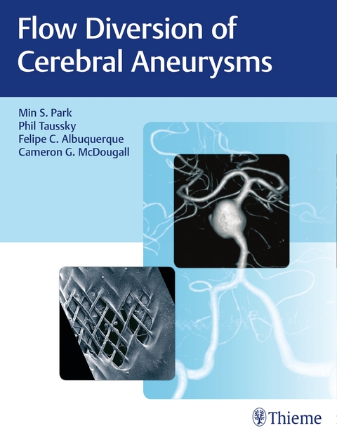 Flow Diversion of Cerebral Aneurysms - Min S. Park, Philipp Taussky, Felipe C. Albuquerque, Cameron G. McDougall