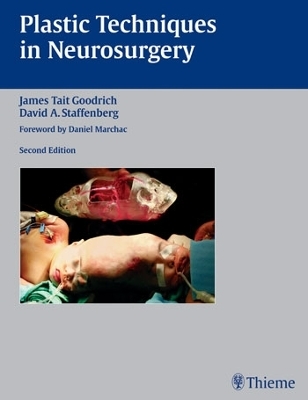 Plastic Techniques in Neurosurgery - 