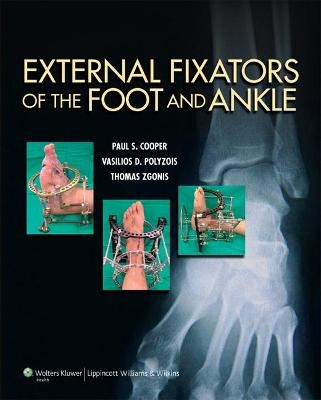 External Fixators of the Foot and Ankle - Dr. Paul Cooper, Dr. Vasilios Polyzois, Thomas Zgonis