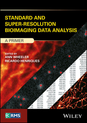 Standard and Super-Resolution Bioimaging Data Analysis - 