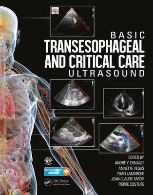 Basic Transesophageal and Critical Care Ultrasound - 