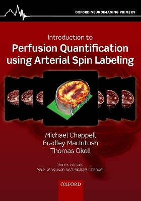 Introduction to Perfusion Quantification using Arterial Spin Labelling - Michael Chappell, Bradley MacIntosh, Thomas Okell