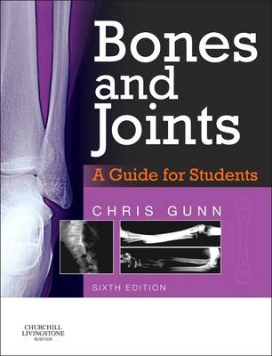 Bones and Joints - Chris Gunn