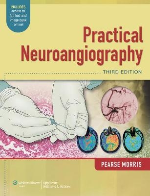 Practical Neuroangiography - P. Pearse Morris