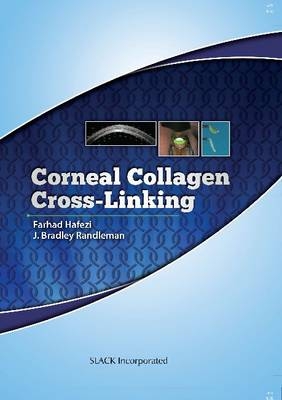 Corneal Collagen Cross Linking - J. Bradley Randleman, Farhad Hafezi