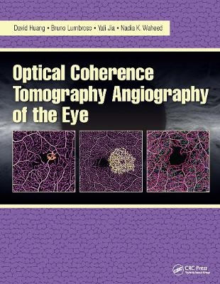 Optical Coherence Tomography Angiography of the Eye - David Huang, Bruno Lumbroso, Yali Jia, Nadia Waheed